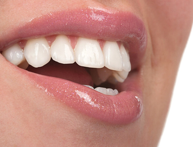 close up of a womans teeth