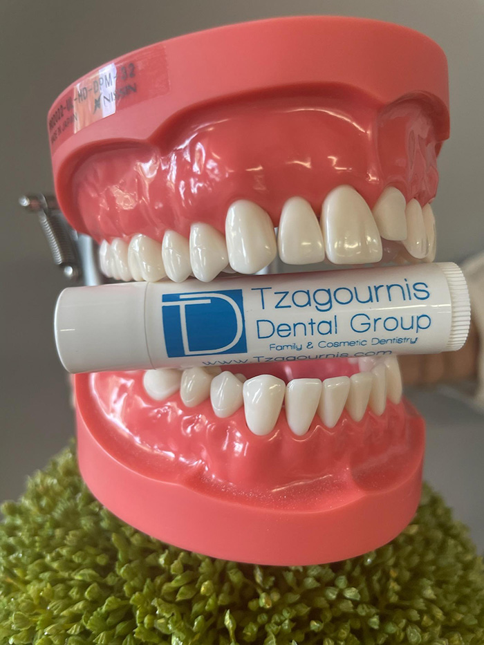 Model of mouth holding chapstick with Tzagournis Dental Group of Upper Arlington logo