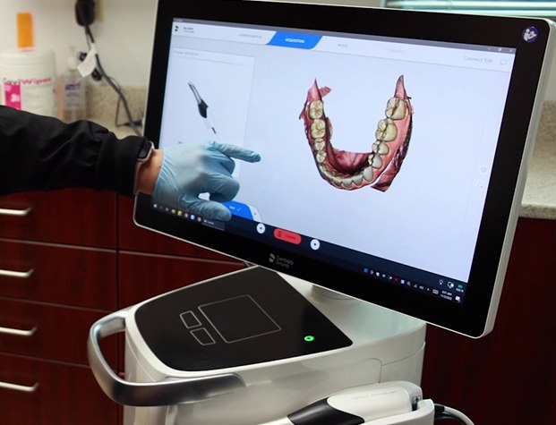 Dentist pointing to monitor with digital model of row of teeth
