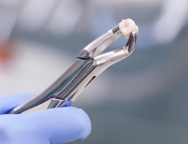 Dental forceps holding an extracted tooth