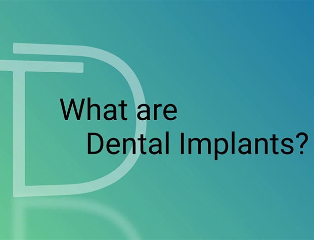 Text reading what are dental implants